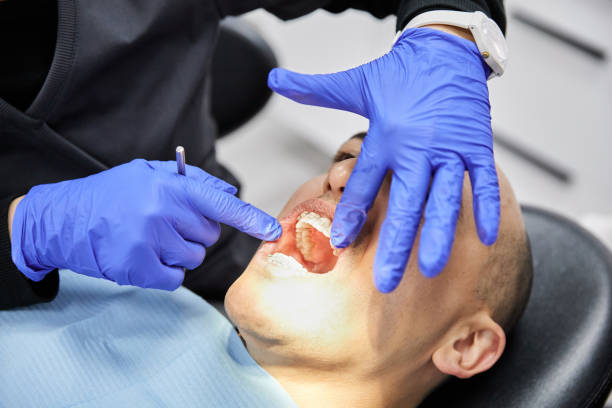 Best Emergency Tooth Extraction in Live Oak, TX