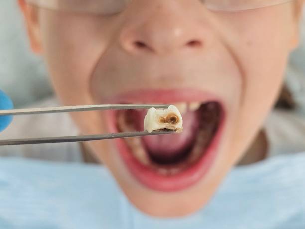 Best Same-Day Emergency Dentist in Live Oak, TX